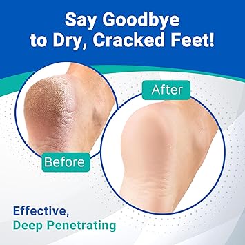 Dermal Therapy Heel Care 300 g